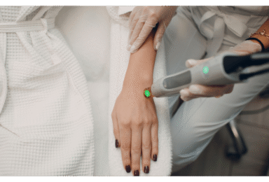 טיפים להכנה להסרת שיער בלייזר: איך להשיג את התוצאות הטובות ביותר