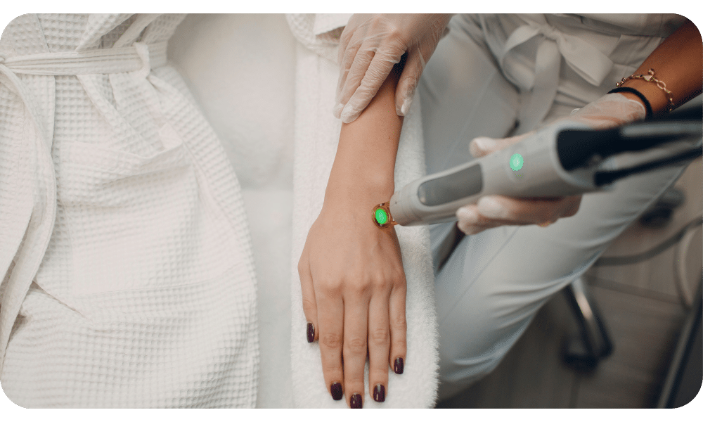 article image - טיפים להכנה להסרת שיער בלייזר: איך להשיג את התוצאות הטובות ביותר