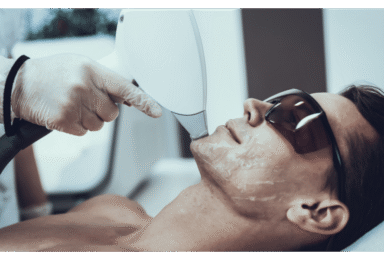 הסרת שיער בלייזר לסוגי עור שונים – כל מה שצריך לדעת