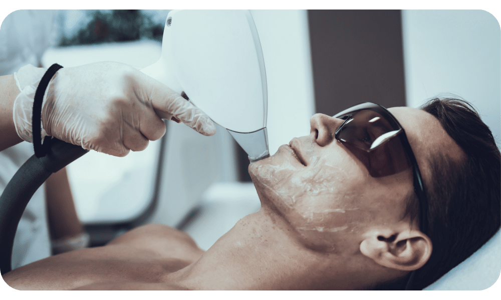 article image - הסרת שיער בלייזר לסוגי עור שונים – כל מה שצריך לדעת